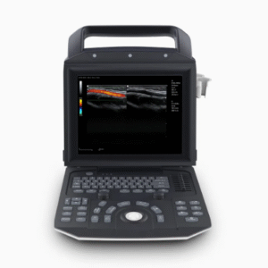 Portable Medical Ultrasound Instrument for Human Scanning Color Doppler Price